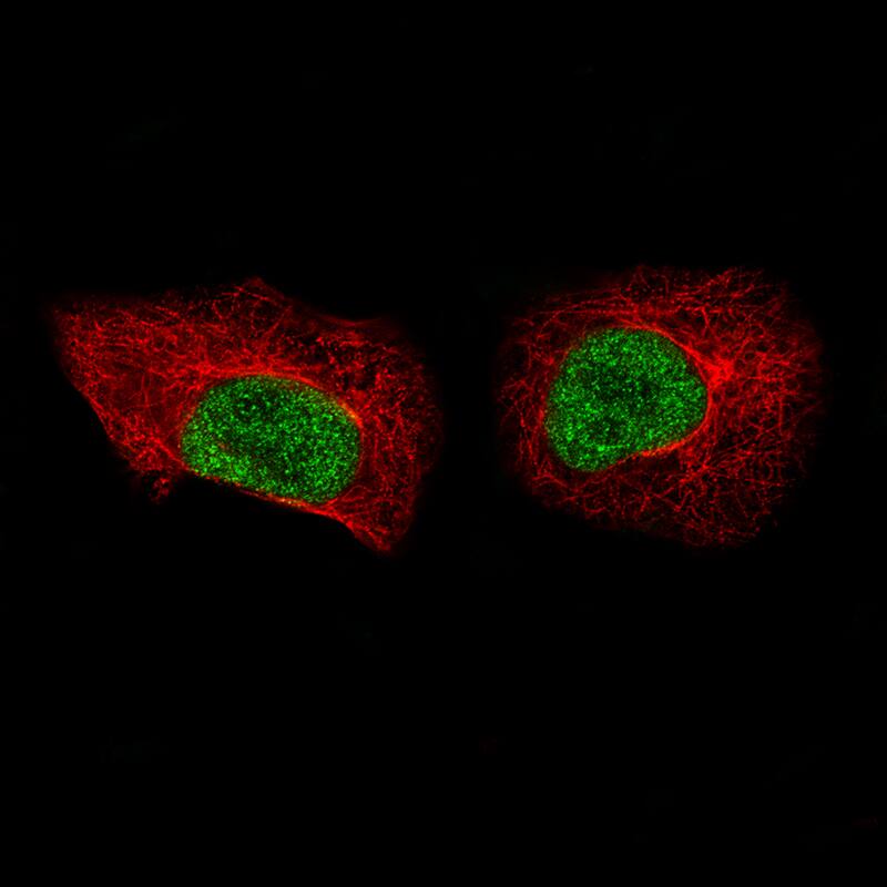 Staining of A549 cells using the Anti-MKL2 monoclonal antibody) .