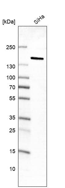 Analysis in human cell line SiHa.