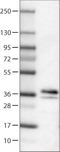 Lane 1: Marker [kDa]Lane 2: Human brain tissue lysate 