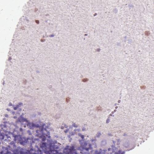 Staining of human cerebellum shows moderate nuclear positivity in the molecular layer.