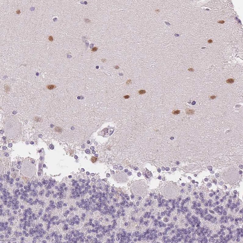 Staining of human cerebellum shows moderate positivity in cells in molecular layer.