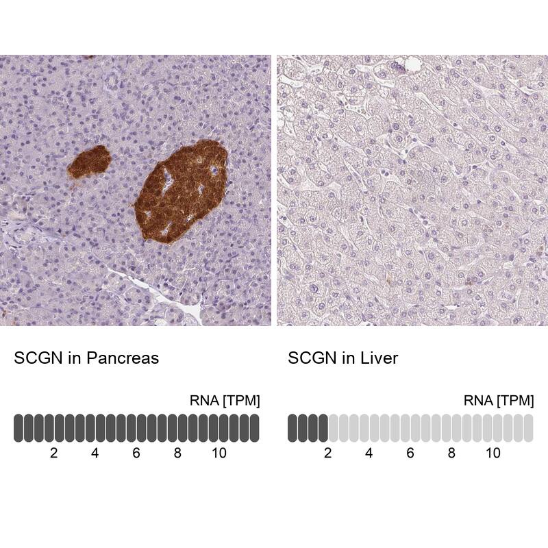 Analysis in human pancreas and liver tissues using NBP3-44031 antibody. Corresponding Secretagogin RNA-seq data are presented for the same tissues.