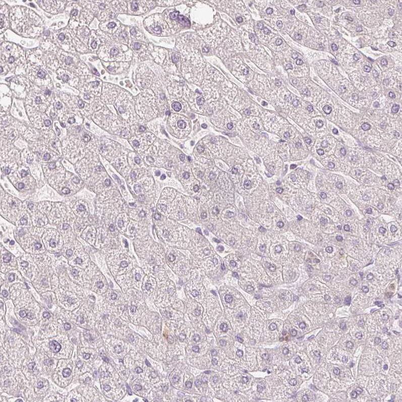 Staining of human liver shows no positivity in hepatocytes as expected.