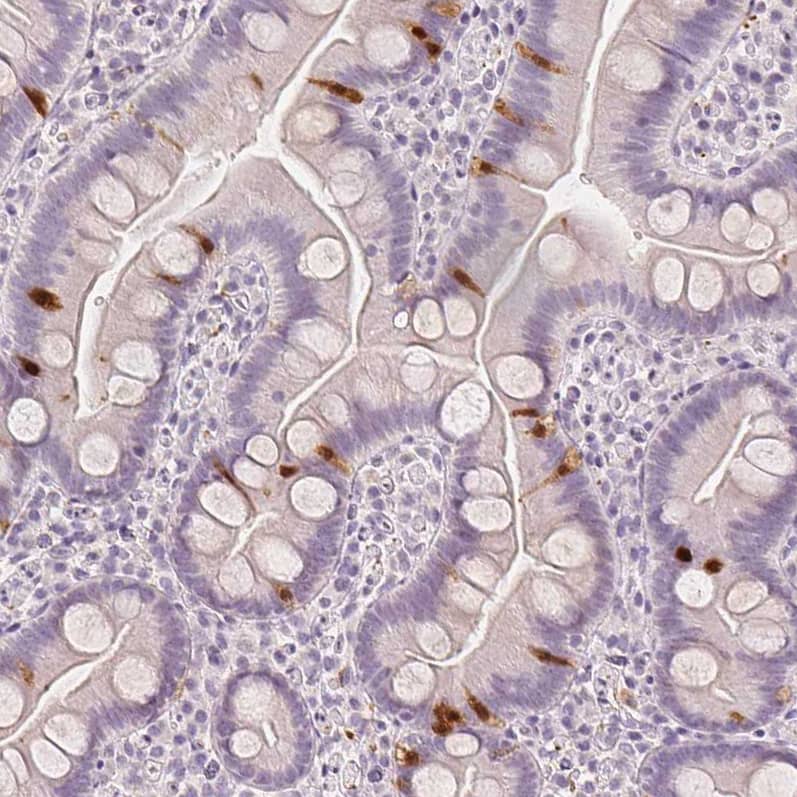 Staining of human small intestine shows moderate to strong positivity in enteroendocrine cells.