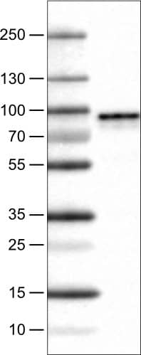 Lane 1: Marker [kDa]Lane 2: Human cell line U-251 MG