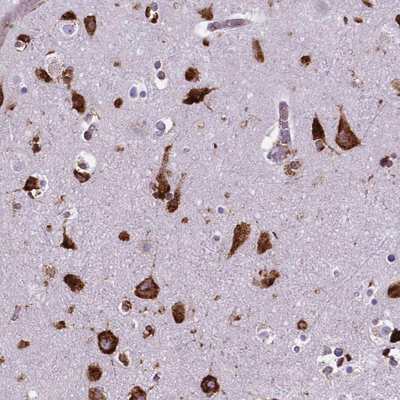 Staining of human cerebral cortex shows strong cytoplasmic positivity in neurons.