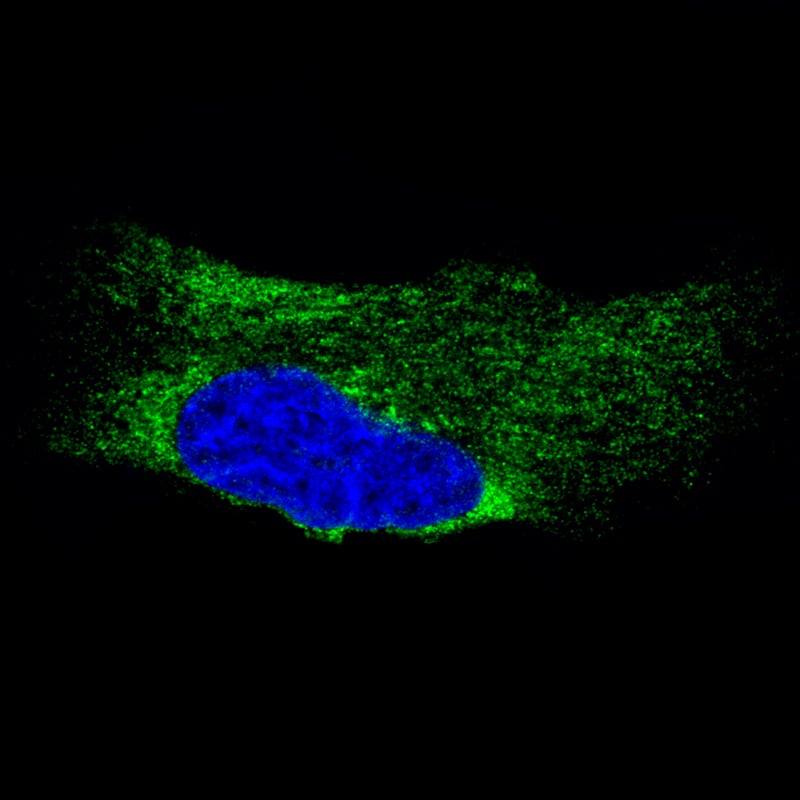 Staining of U-251 cells using the Anti-Metadherin monoclonal antibody) .