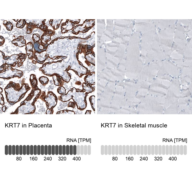 Analysis in human placenta and skeletal muscle tissues using NBP3-44035 antibody. Corresponding Cytokeratin 7 RNA-seq data are presented for the same tissues.