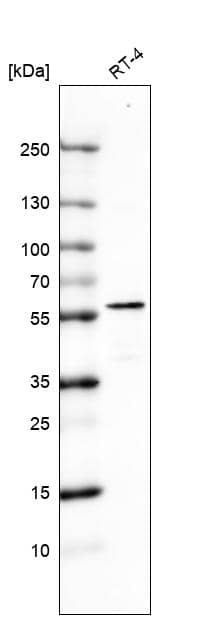 Analysis in human cell line RT-4.