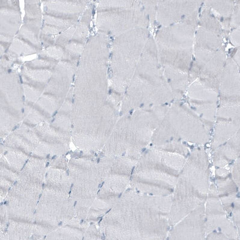 Staining of human skeletal muscle shows no cytoplasmic positivity in myocytes as expected.