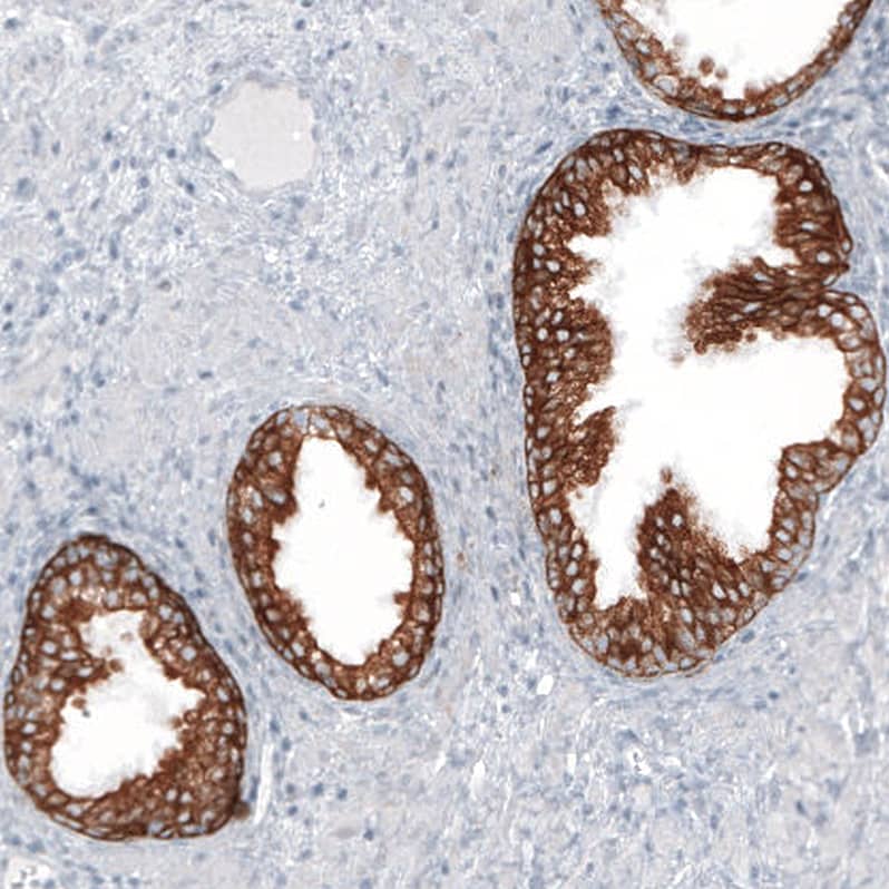Staining of human prostate shows strong cytoplasmic positivity in glandular cells.