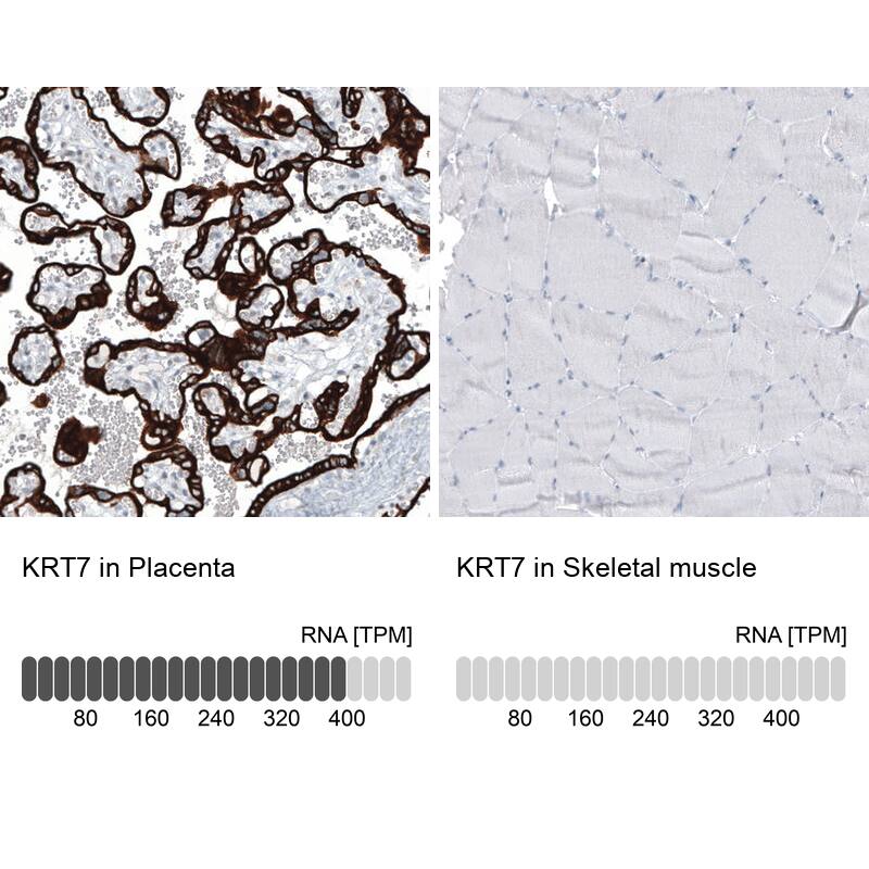 Analysis in human placenta and skeletal muscle tissues using NBP3-44036 antibody. Corresponding Cytokeratin 7 RNA-seq data are presented for the same tissues.