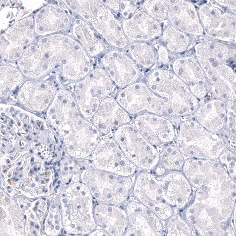 <b>Orthogonal Strategies Validation. </b>Staining of human kidney shows no positivity in cells in tubules as expected.