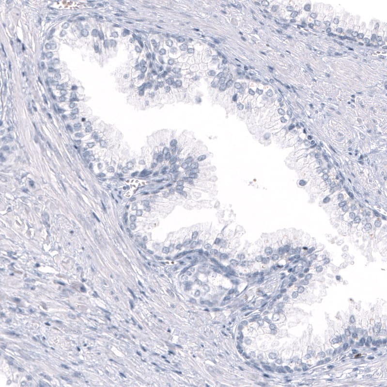 Staining of human prostate shows no positivity in glandular cells as expected.
