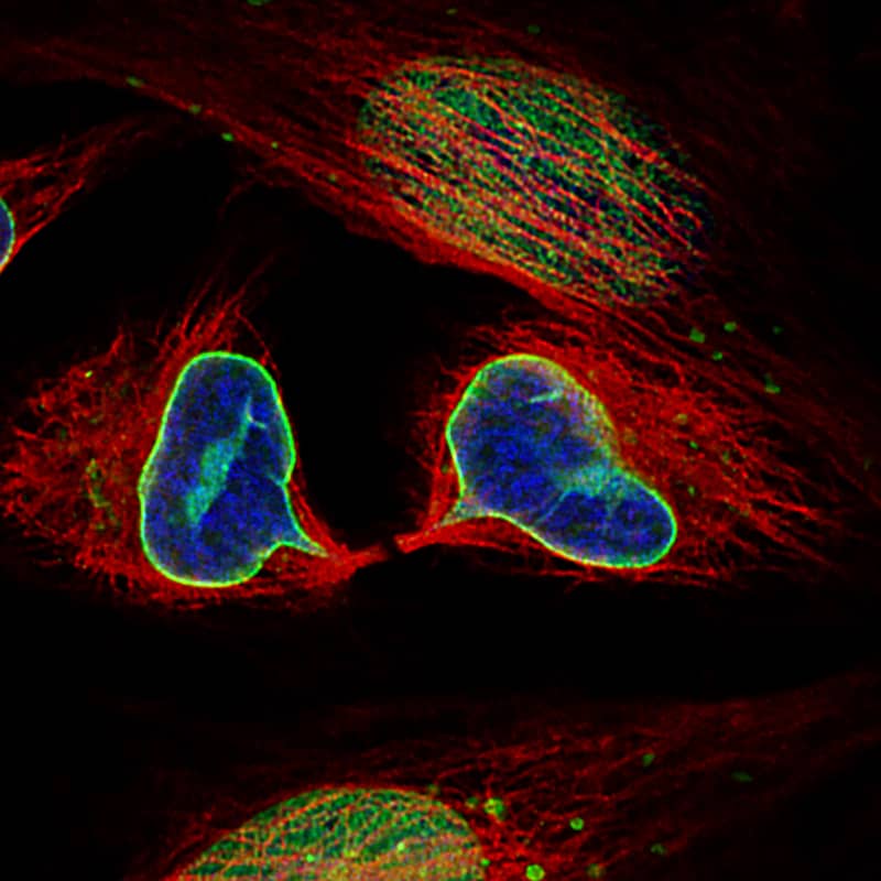 Staining of HeLa cells using the Anti-Lamin B1 monoclonal antibody) .
