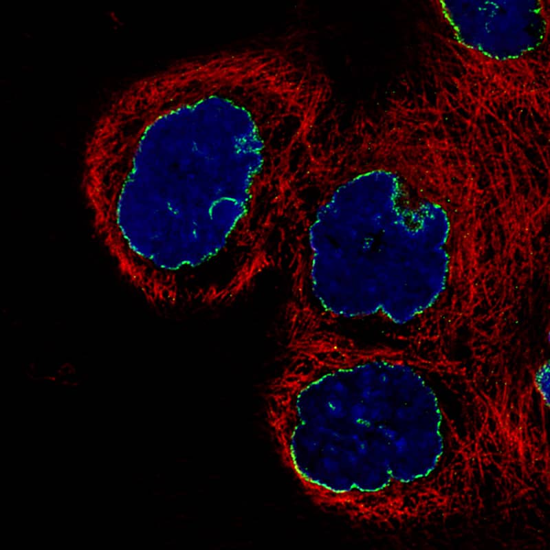 Staining of A-431 cells using the Anti-Lamin B1 monoclonal antibody) .
