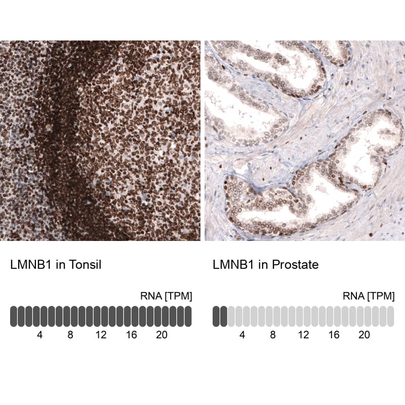 Analysis in human tonsil and prostate tissues using NBP3-44038 antibody. Corresponding Lamin B1 RNA-seq data are presented for the same tissues.