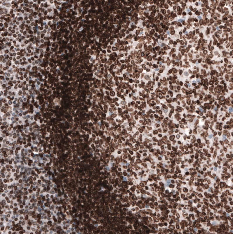 Staining of human tonsil shows strong nuclear membrane positivity in lymphoid cells.