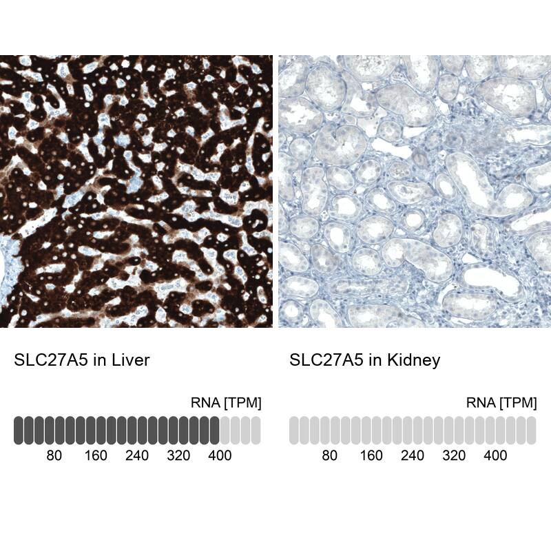 Analysis in human liver and kidney tissues using NBP3-44039 antibody. Corresponding FATP5/SLC27A5 RNA-seq data are presented for the same tissues.