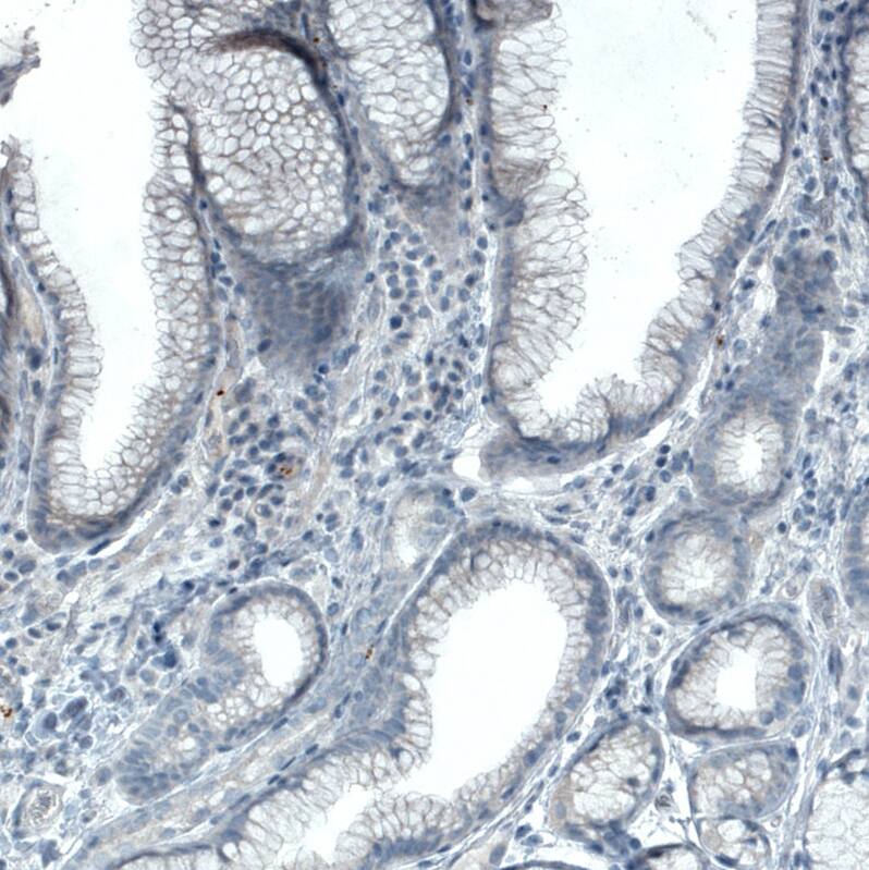 Staining of human duodenum shows no positivity in glandular cells as expected.