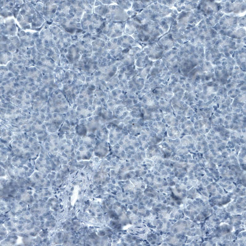 Staining of human pancreas shows no positivity in exocrine glandular cells as expected.