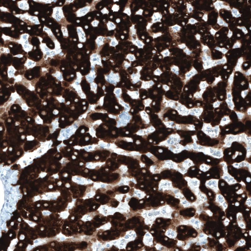 Staining of human liver shows strong cytoplasmic positivity in hepatocytes.