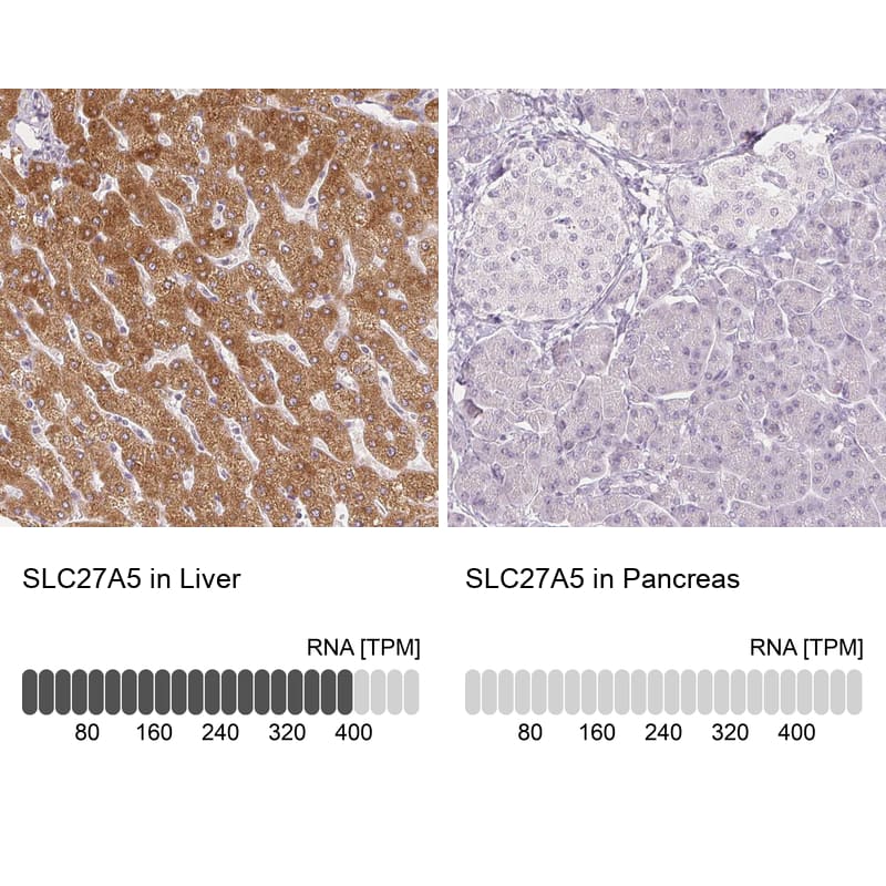 Analysis in human liver and pancreas tissues using NBP3-44040 antibody. Corresponding FATP5/SLC27A5 RNA-seq data are presented for the same tissues.
