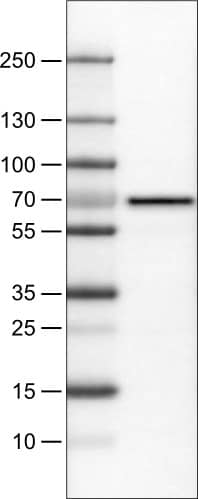 Lane 1: Marker [kDa]Lane 2: Human liver tissue lysate