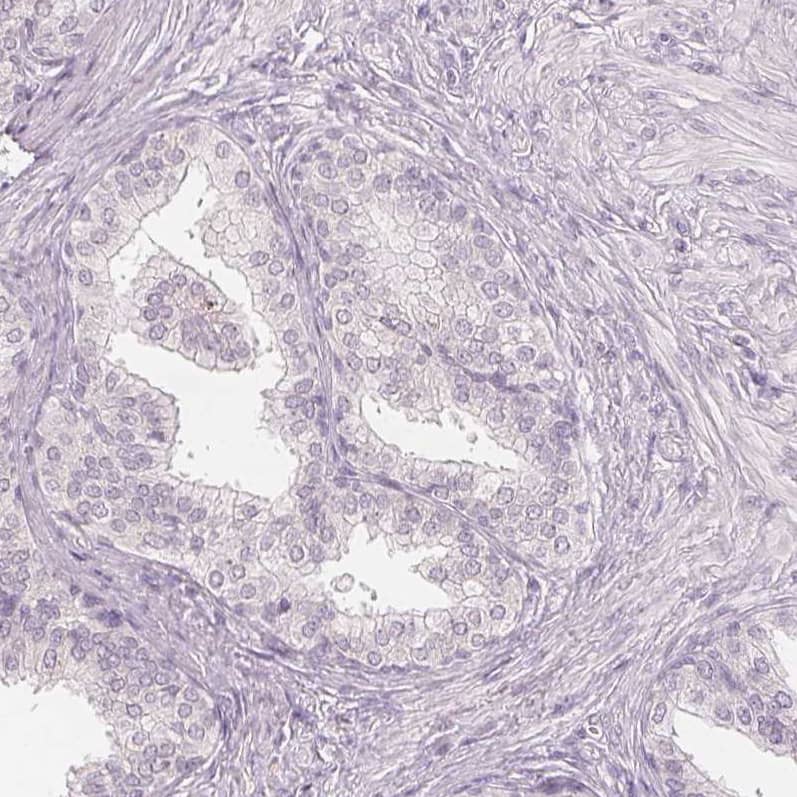 Staining of human prostate shows no positivity in glandular cells as expected.
