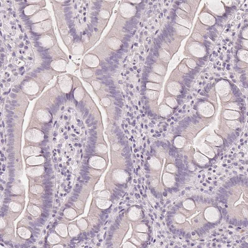 Staining of human small intestine shows no positivity in glandular cells as expected.