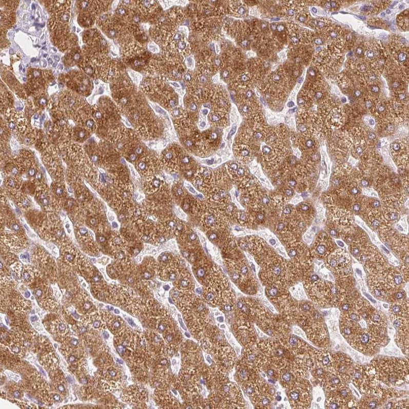 Staining of human liver shows strong cytoplasmic positivity in hepatocytes.