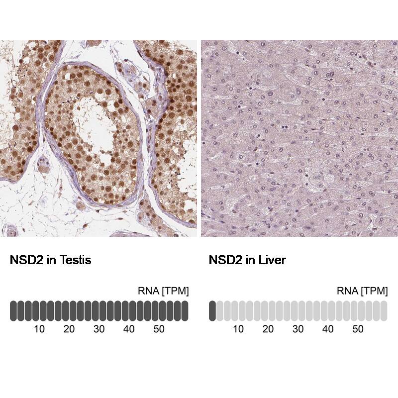 Analysis in human testis and liver tissues using NBP3-44041 antibody. Corresponding WHSC1 RNA-seq data are presented for the same tissues.