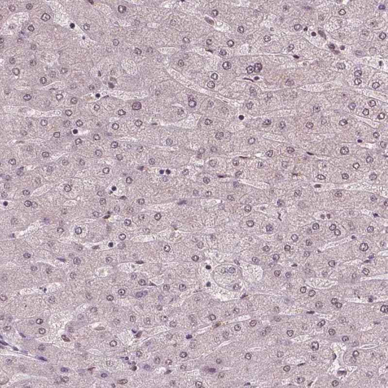 Staining of human liver shows no positivity in hepatocytes as expected.