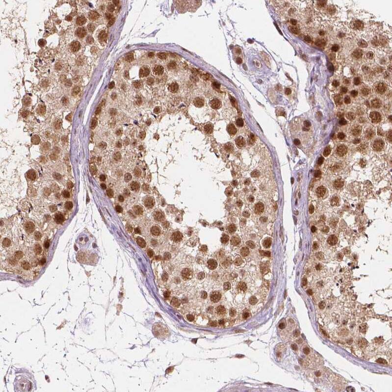 Staining of human testis shows moderate to strong nuclear positivity in cells in seminiferous ducts.
