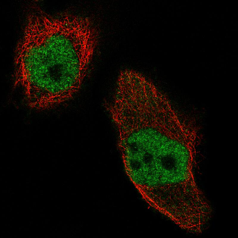Staining of U-251 cells using the Anti-WHSC1 monoclonal antibody) .