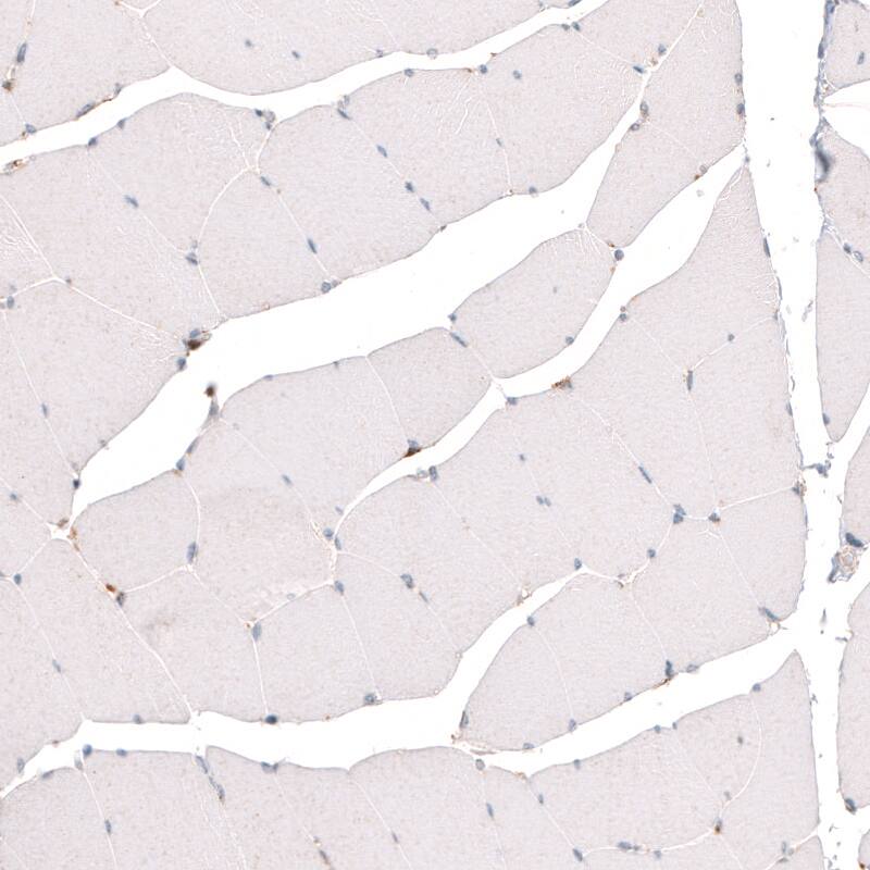 Staining of human skeletal muscle shows absence of positivity in striated muscle fibers as expected (negative control).