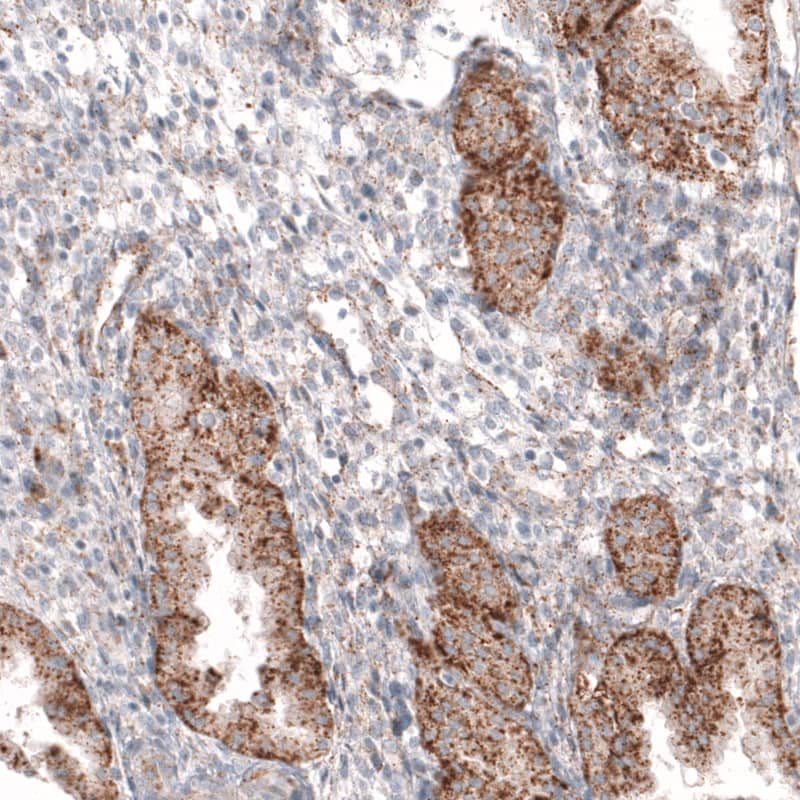 Staining of human endometrium shows moderate granular cytoplasmic immunoreactivity in glandular cells.