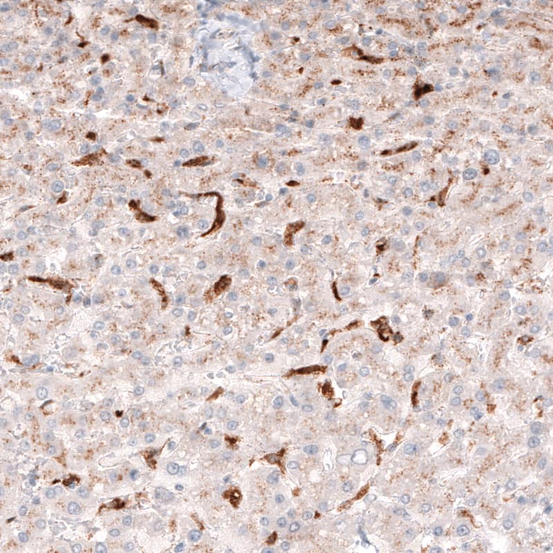 Staining of human liver shows cytoplasmic immunoreactivity in Kupffer cells.