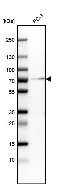 Analysis in human cell line PC-3.