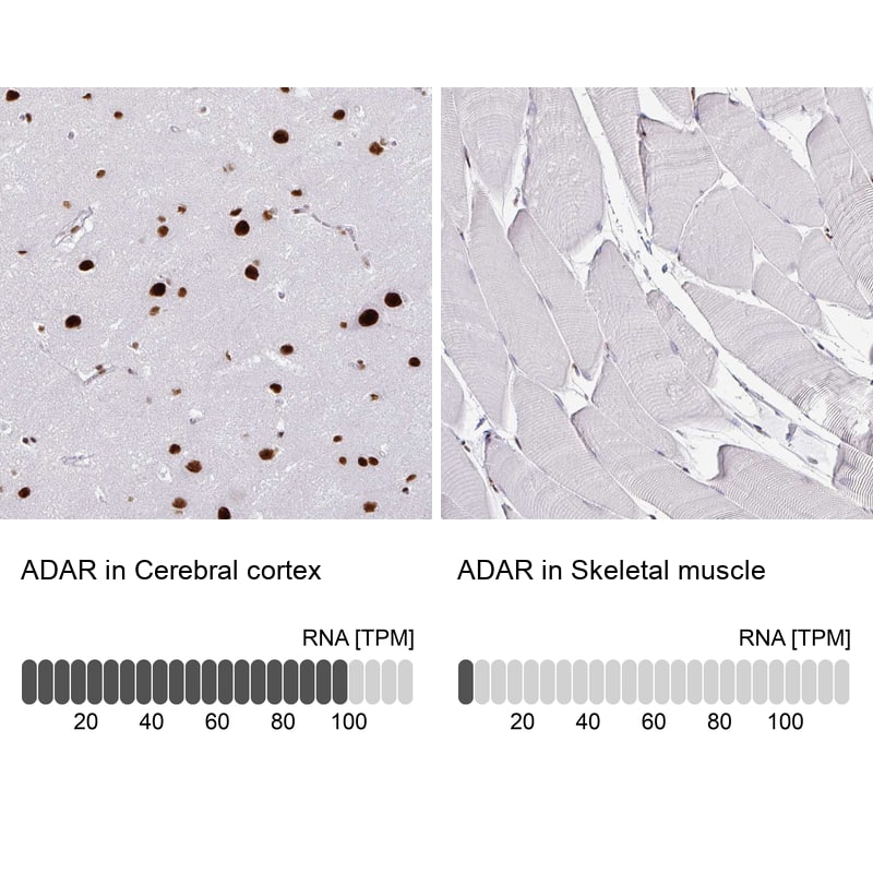 Analysis in human cerebral cortex and skeletal muscle tissues using NBP3-44046 antibody. Corresponding ADAR RNA-seq data are presented for the same tissues.