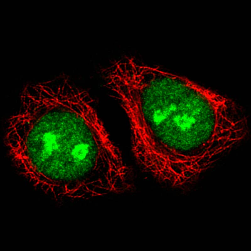 Staining of A549 cells using the Anti-ADAR monoclonal antibody) .