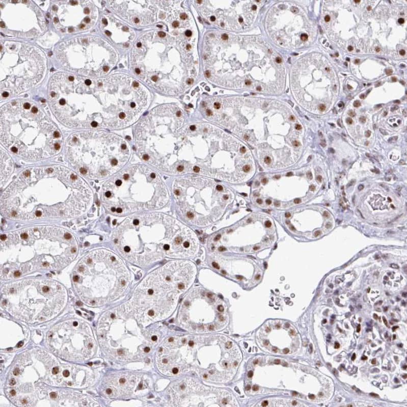 Staining of human kidney shows strong nuclear positivity in cells in tubules.