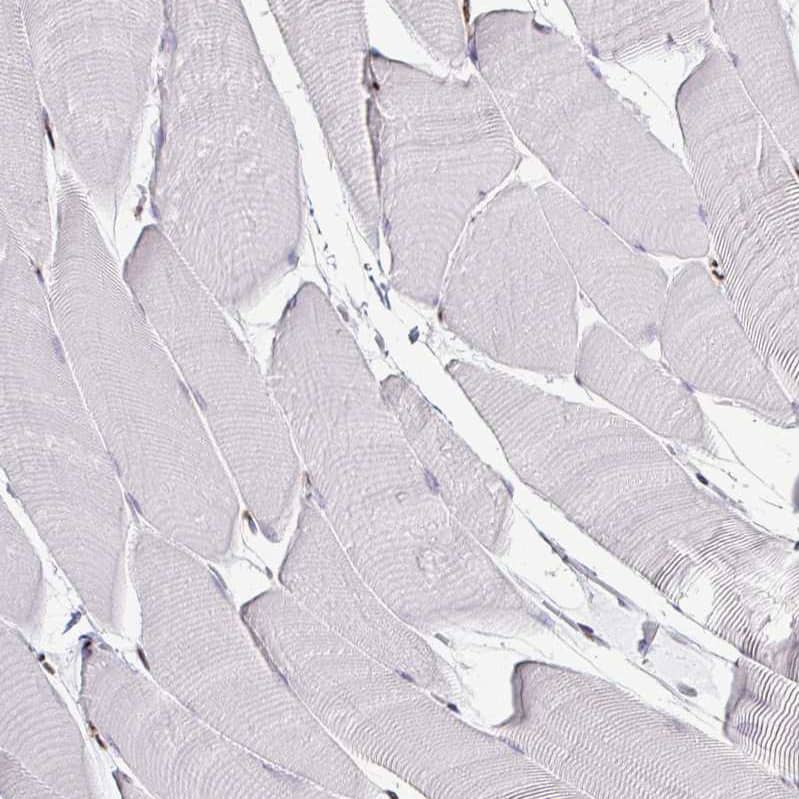 Staining of human skeletal muscle shows no positivity in myocytes as expected.