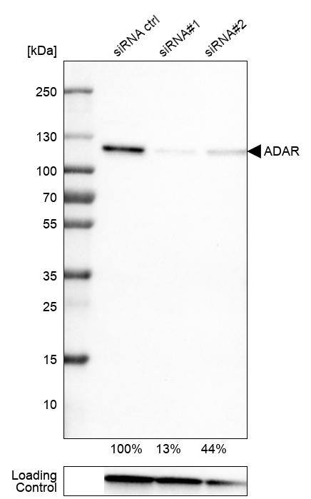 Analysis in U-251MG cells transfected with control siRNA, target specific siRNA probe #1 and #2, using Anti-ADAR antibody. Remaining relative intensity is presented. Loading control: Anti-GAPDH.