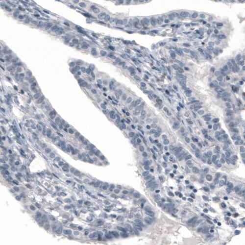 Staining of human fallopian tube shows absence of immunoreactivity (negative control).