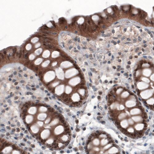 Staining of human colon shows cytoplasmic positivity in glandular cells.