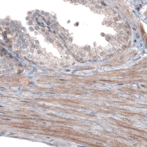 Staining of human prostate shows moderate cytoplasmic immunoreactivity in smooth muscle.