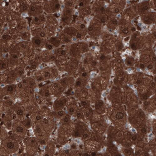 Staining of human liver shows strong positivity in hepatocytes.