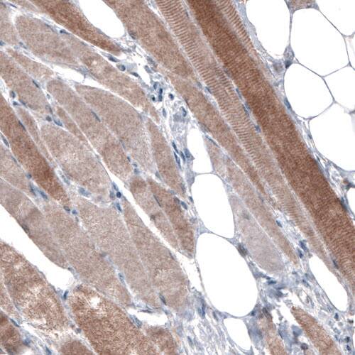 Staining of human skeletal muscle shows moderate cytoplasmic immunoreactivity in muscle fibers.