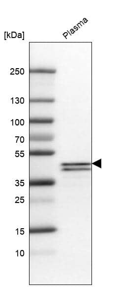 Analysis in human plasma.